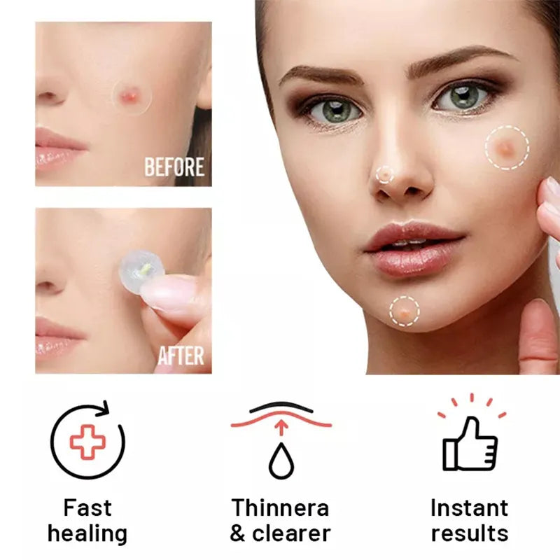 Acne Patch Day & Night Repair