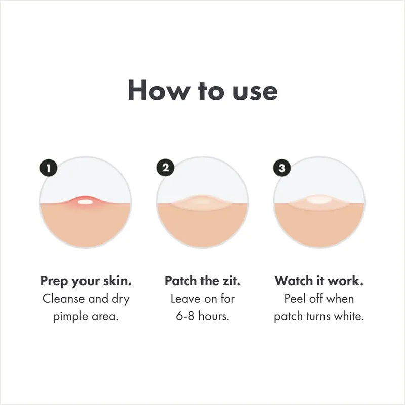 Acne Patch Day & Night Repair